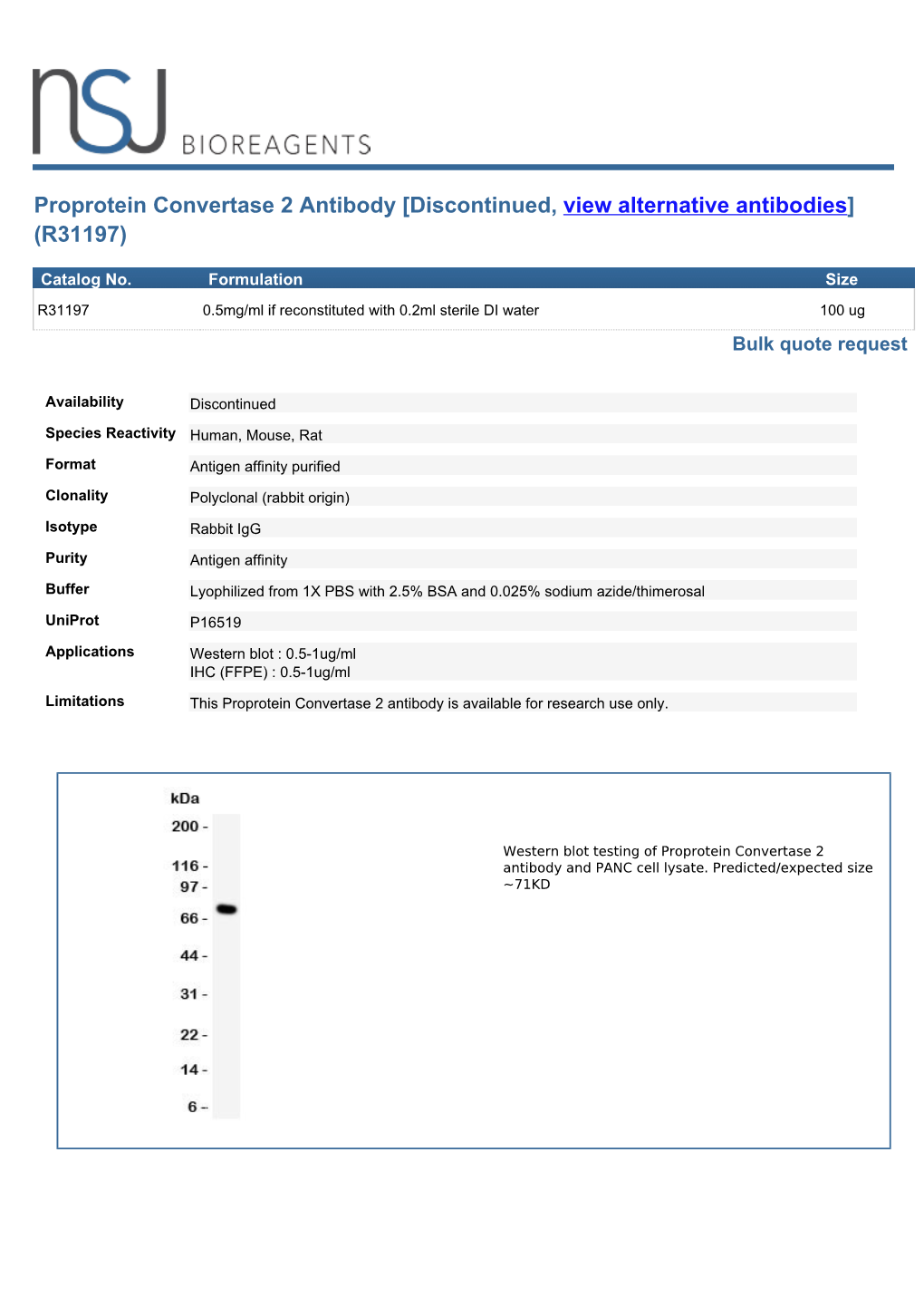 Proprotein Convertase 2 Antibody [Discontinued, View Alternative Antibodies] (R31197)