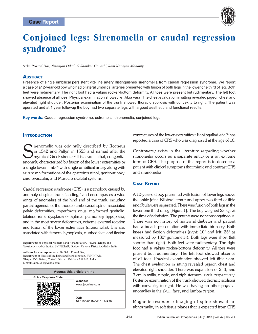 Sirenomelia Or Caudal Regression Syndrome?