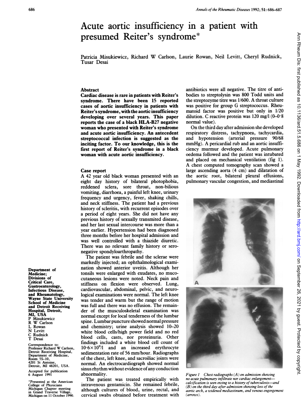 Acute Aortic Insufficiency in a Patient with Presumed Reiter's Syndrome* Ann Rheum Dis: First Published As 10.1136/Ard.51.5.686 on 1 May 1992