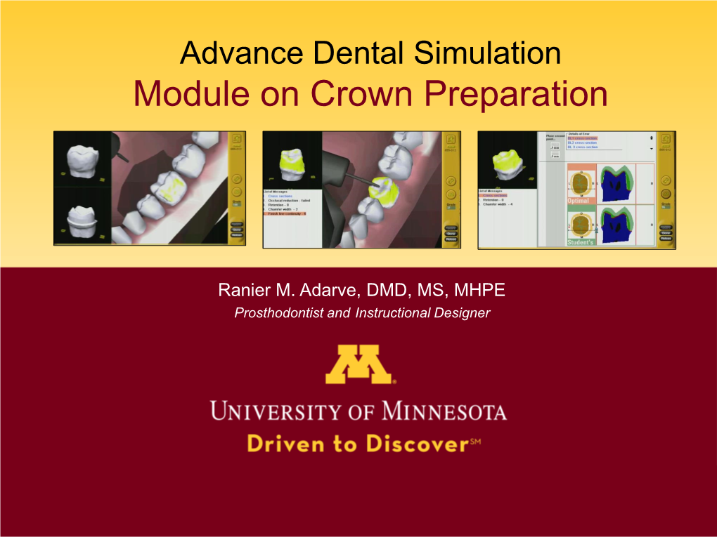 Module on Crown Preparation