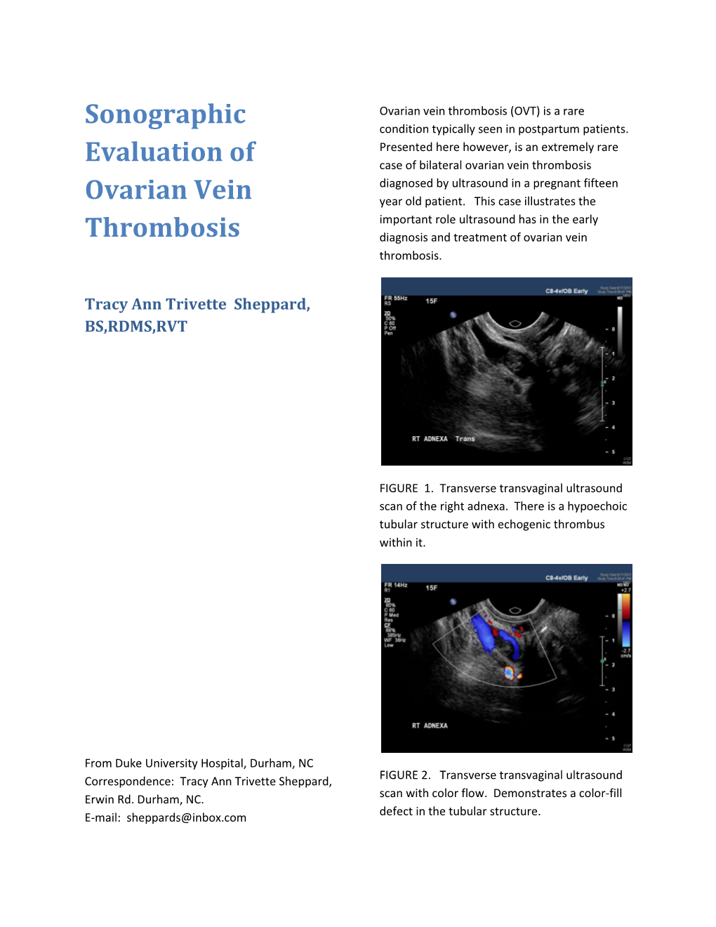 Sonographic Evaluation of Ovarian Vein Thrombosis