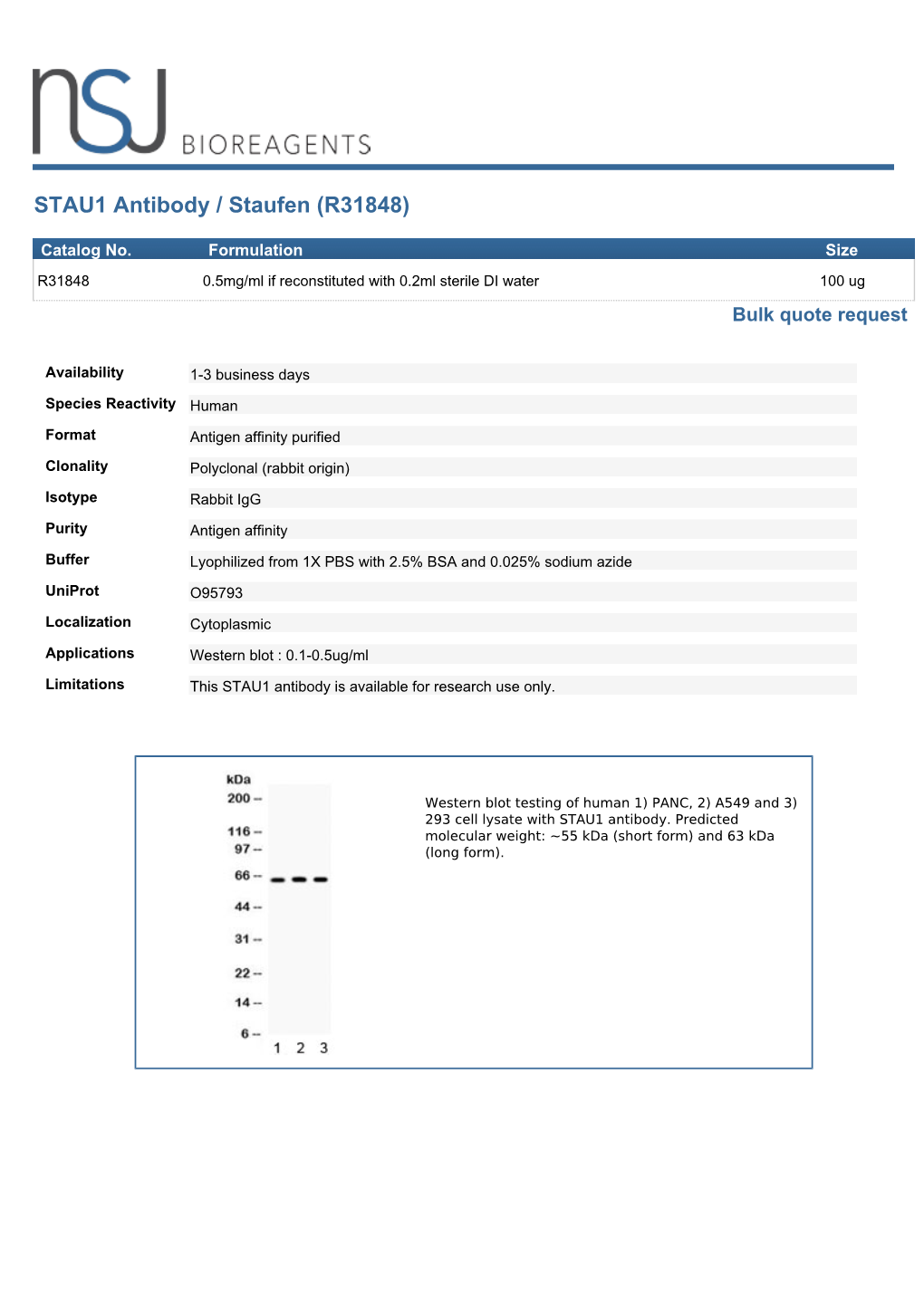 STAU1 Antibody / Staufen (R31848)