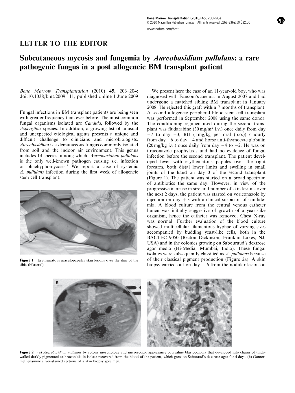 Subcutaneous Mycosis and Fungemia by Aureobasidium Pullulans: a Rare Pathogenic Fungus in a Post Allogeneic BM Transplant Patient