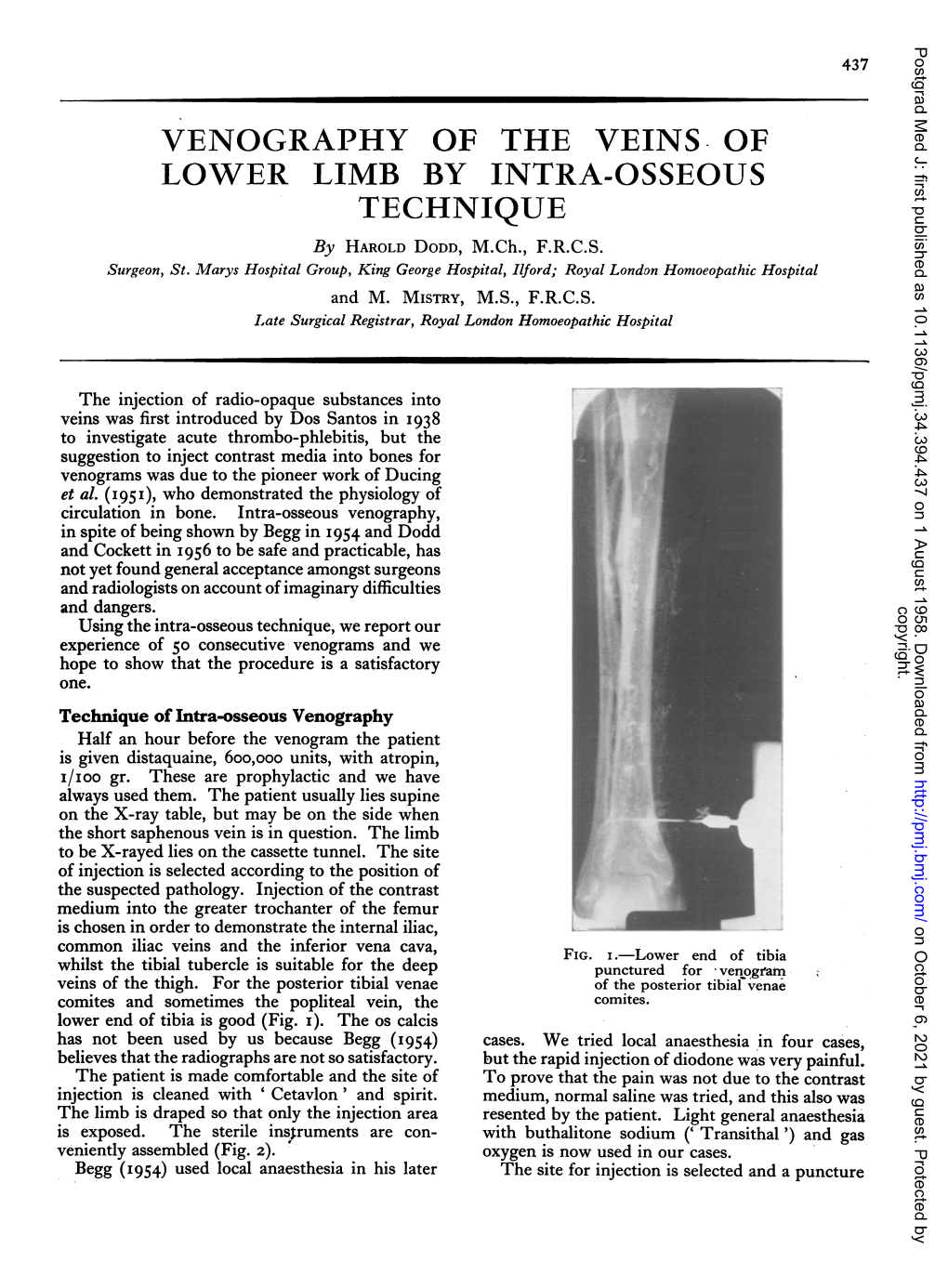 Venography of the Veins of Technique