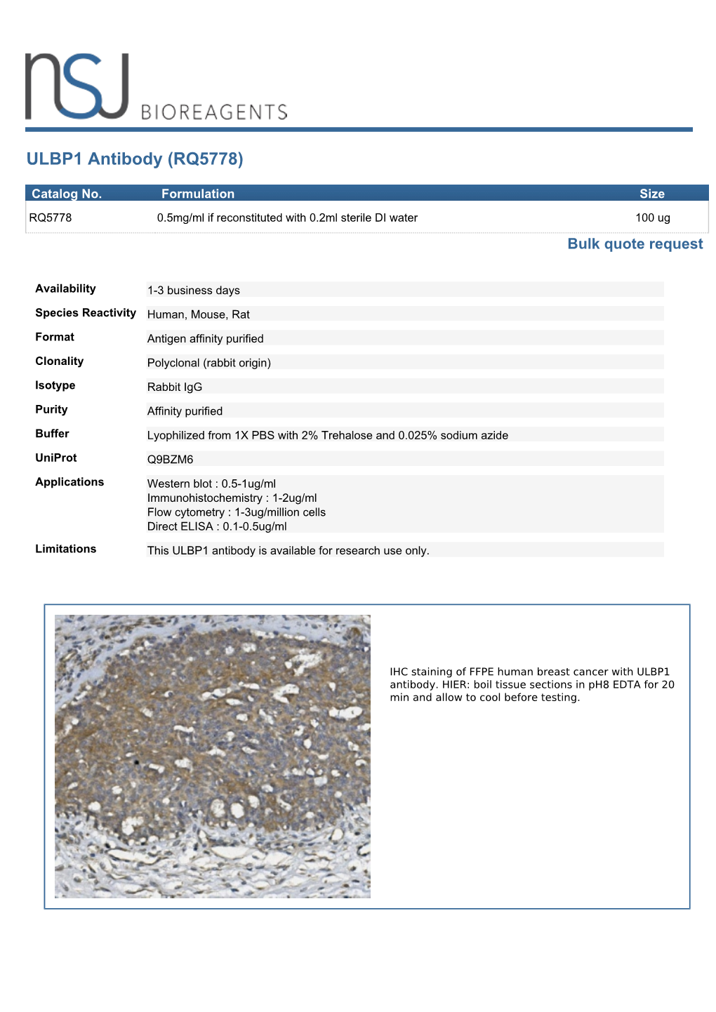 ULBP1 Antibody (RQ5778)