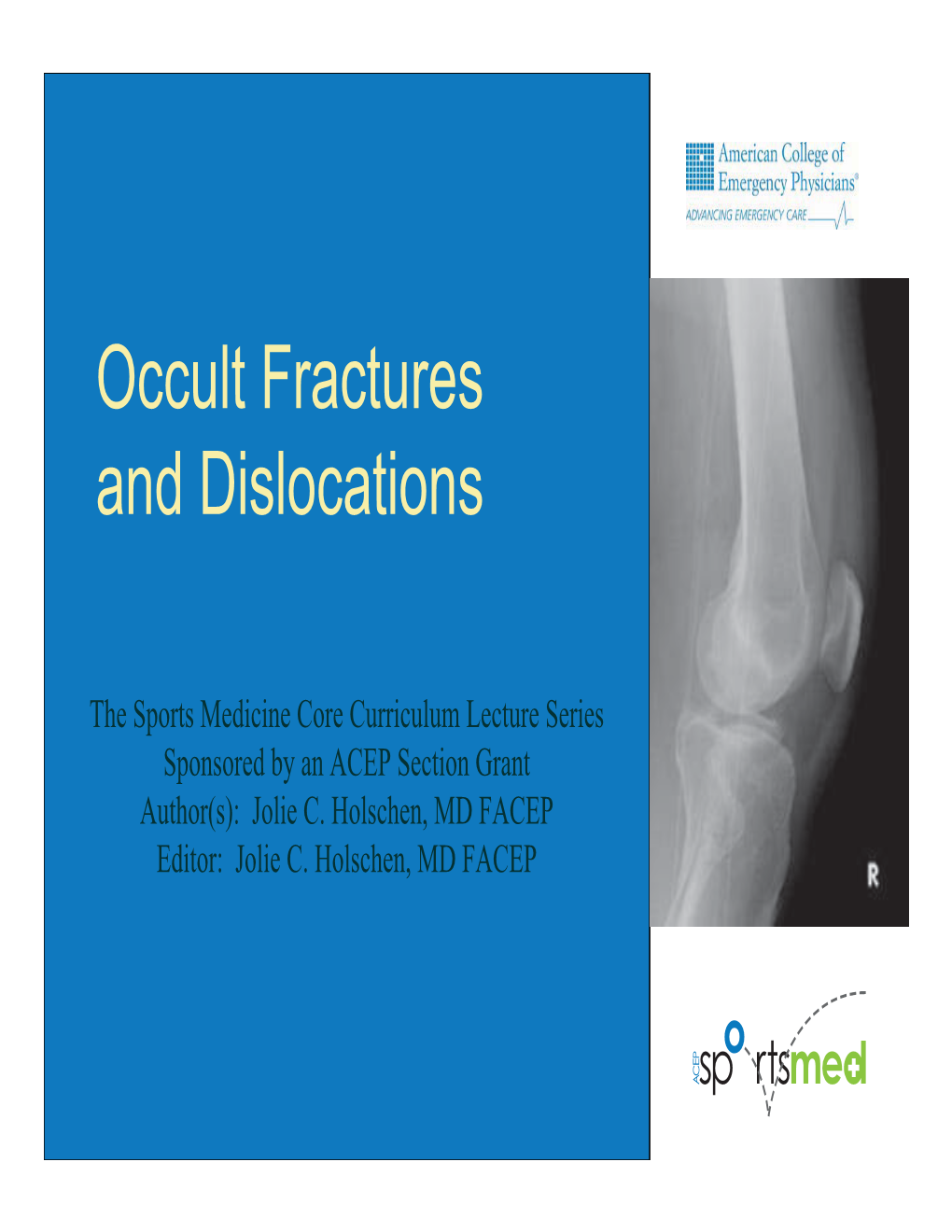 Occult Fractures and Dislocations