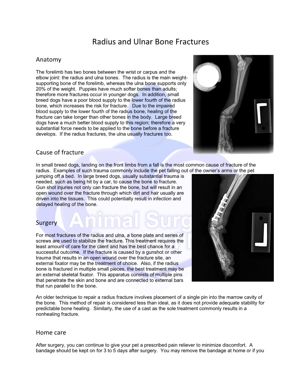 Radius and Ulnar Bone Fractures