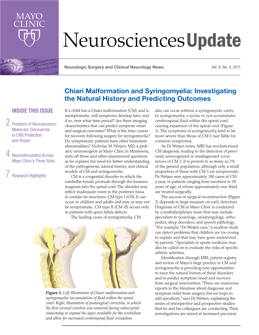 Chiari Malformation and Syringomyelia: Investigating the Natural History and Predicting Outcomes