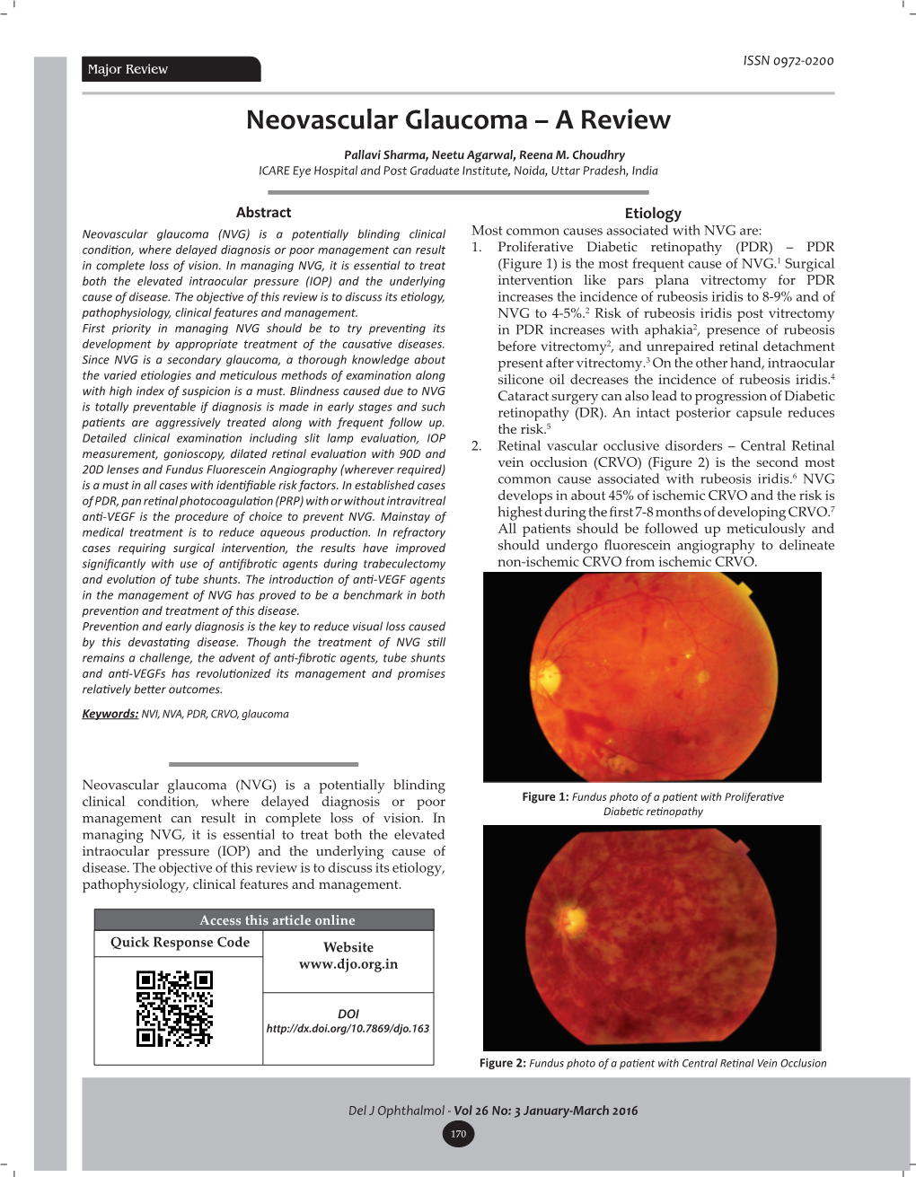 Neovascular Glaucoma – a Review Pallavi Sharma, Neetu Agarwal, Reena M