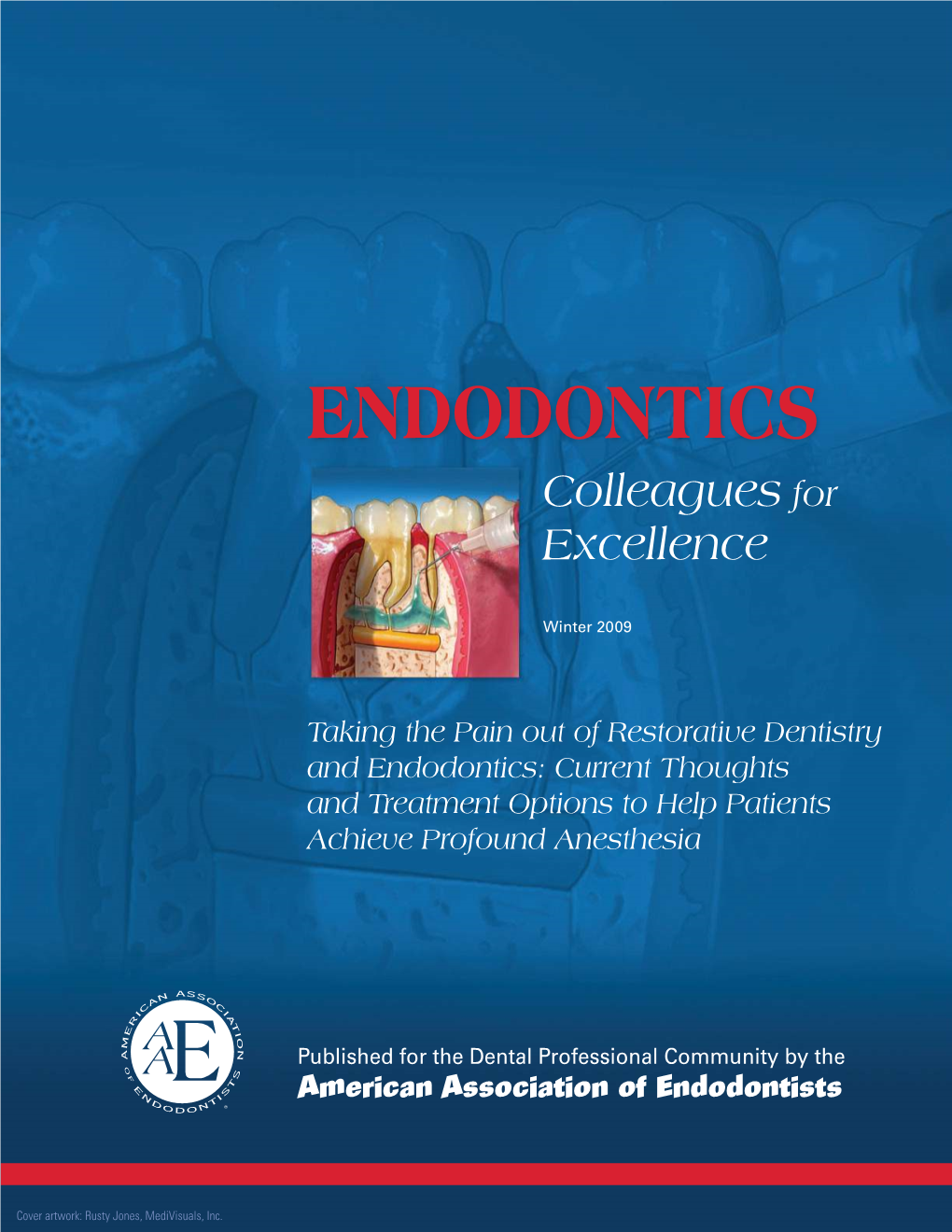 Taking the Pain out of Restorative Dentistry and Endodontics: Current Thoughts and Treatment Options to Help Patients Achieve Profound Anesthesia