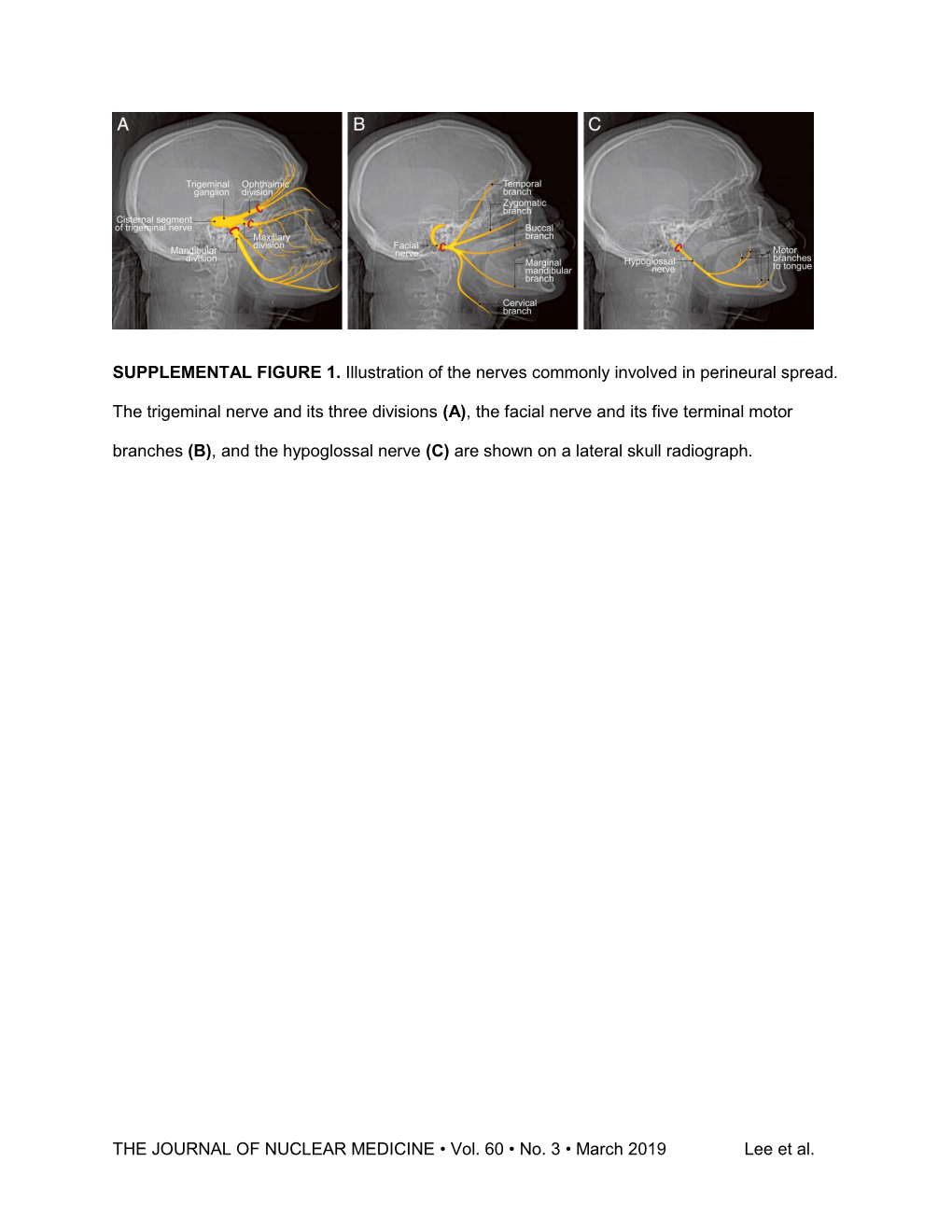 THE JOURNAL of NUCLEAR MEDICINE • Vol. 60 • No. 3 • March 2019 Lee Et Al