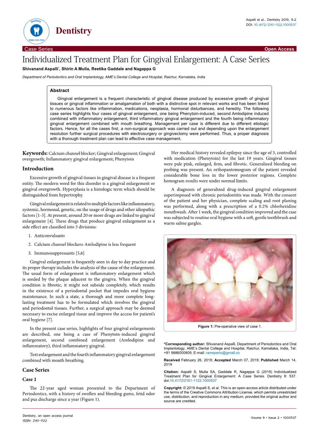 Individualized Treatment Plan for Gingival Enlargement: a Case Series Shivanand Aspalli*, Shirin a Mulla, Reetika Gaddale and Nagappa G