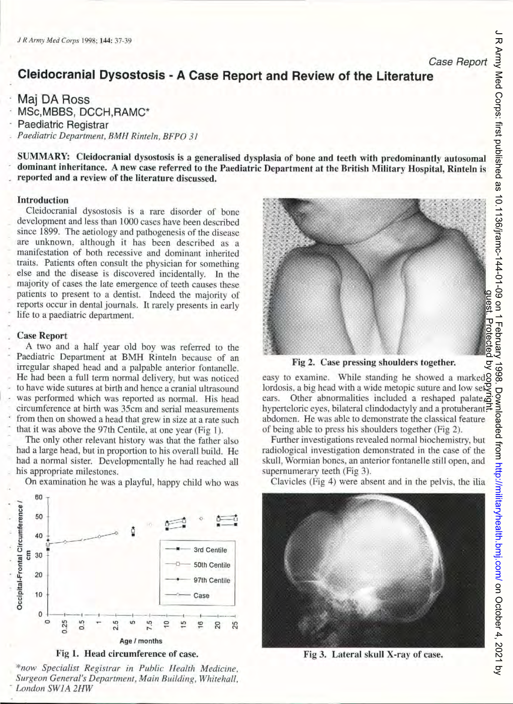 DA Ross. Cleidocranial Dysostosis