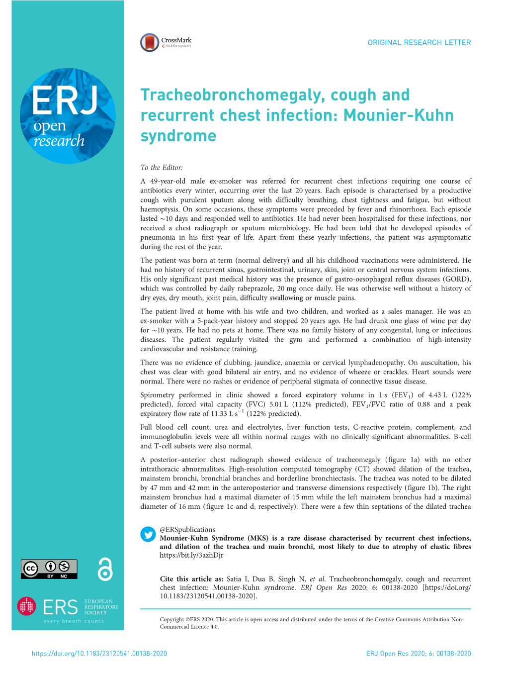 Tracheobronchomegaly, Cough and Recurrent Chest Infection: Mounier-Kuhn Syndrome