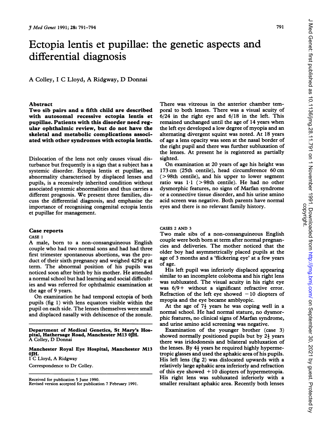 Ectopia Lentis Et Pupillae: the Genetic Aspects and Differential Diagnosis