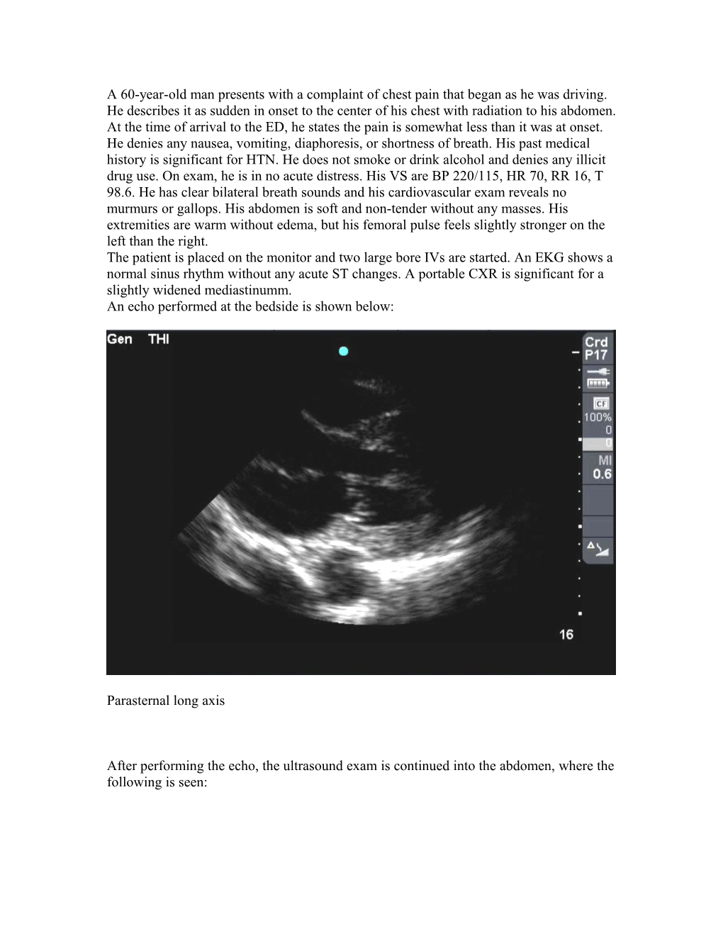 A 60 Year Old Man Presents with a Complaint of Chest Pain That Began As He Was Driving