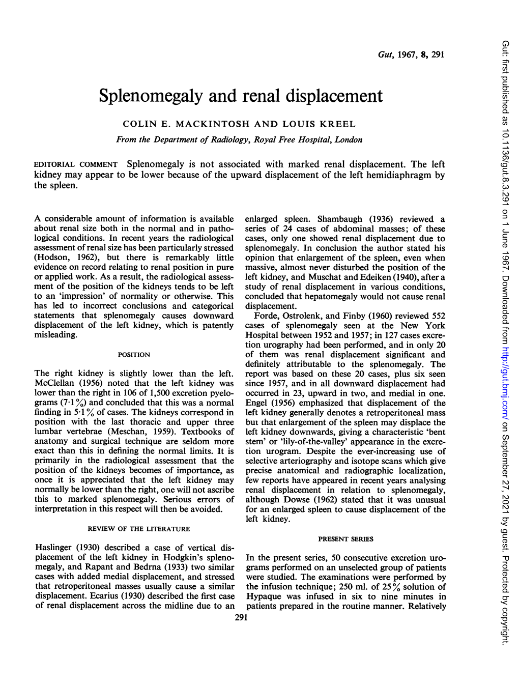 Splenomegaly and Renal Displacement