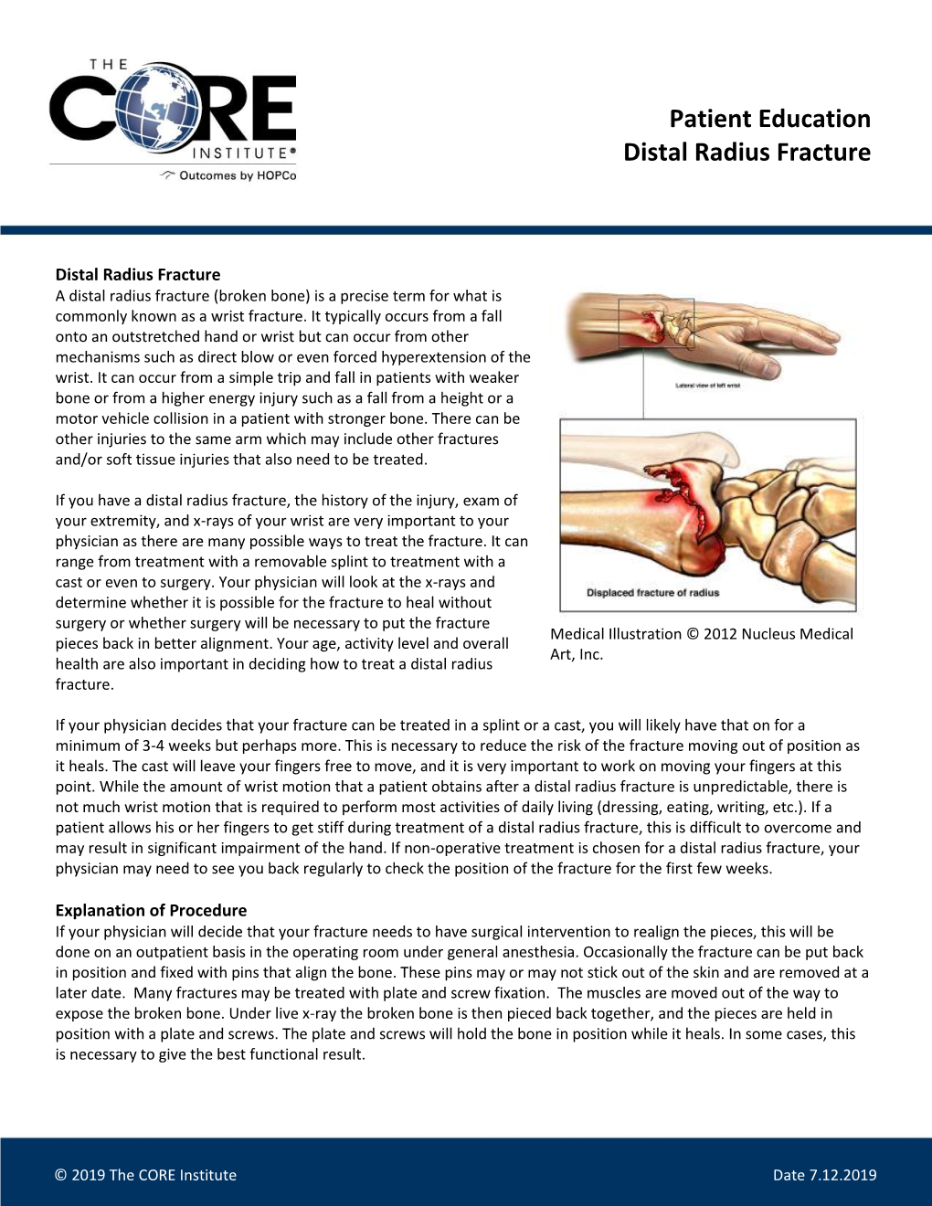 Distal Radius Fracture