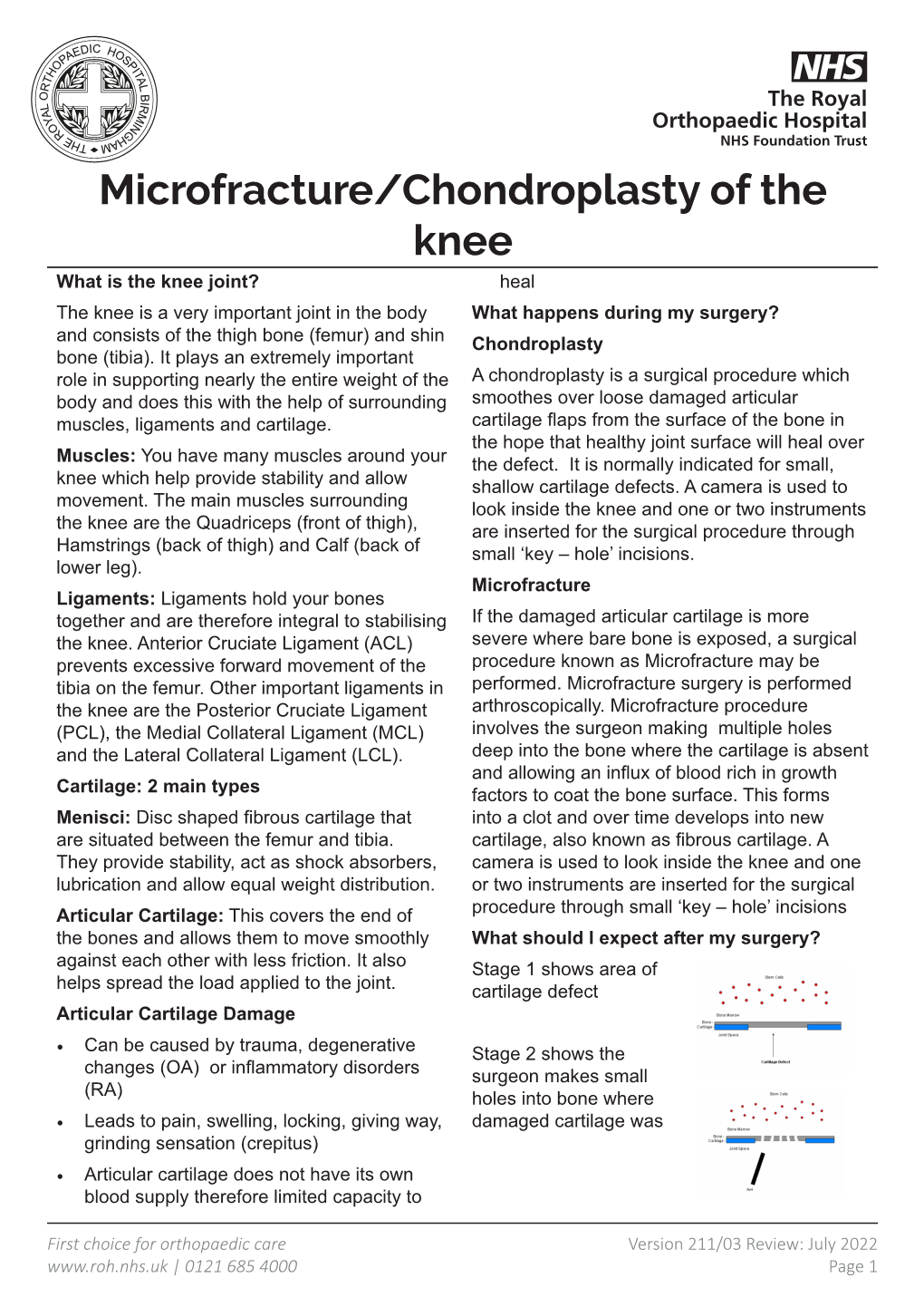 Microfracture/Chondroplasty of the Knee