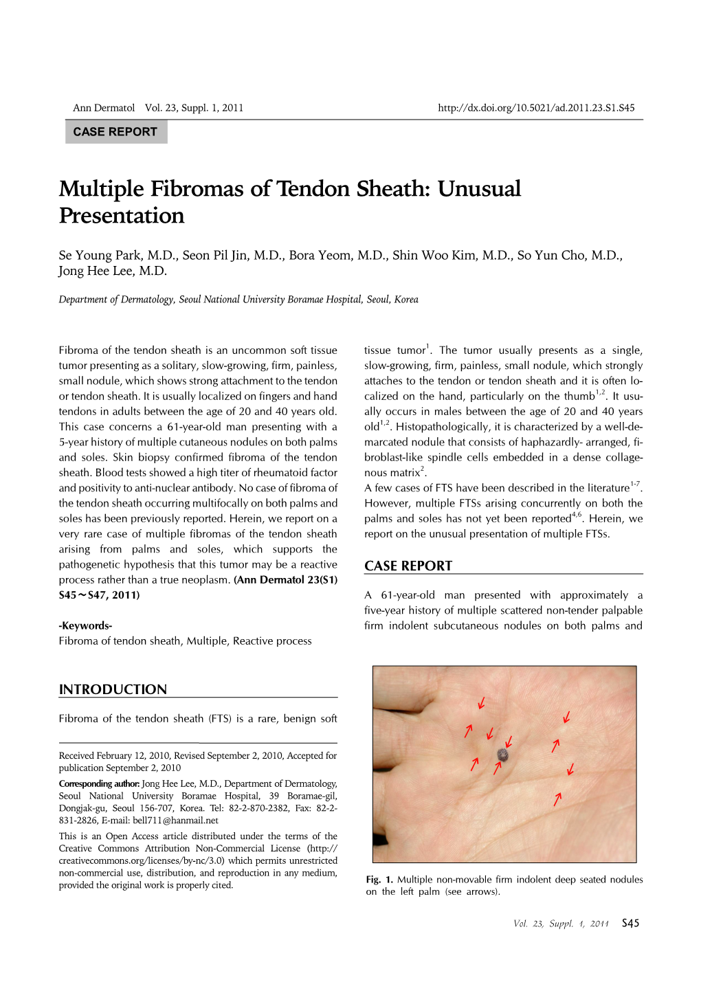 Multiple Fibromas of Tendon Sheath: Unusual Presentation