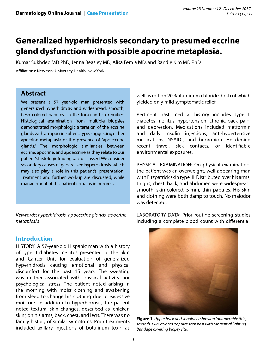 Generalized Hyperhidrosis Secondary to Presumed Eccrine Gland Dysfunction with Possible Apocrine Metaplasia