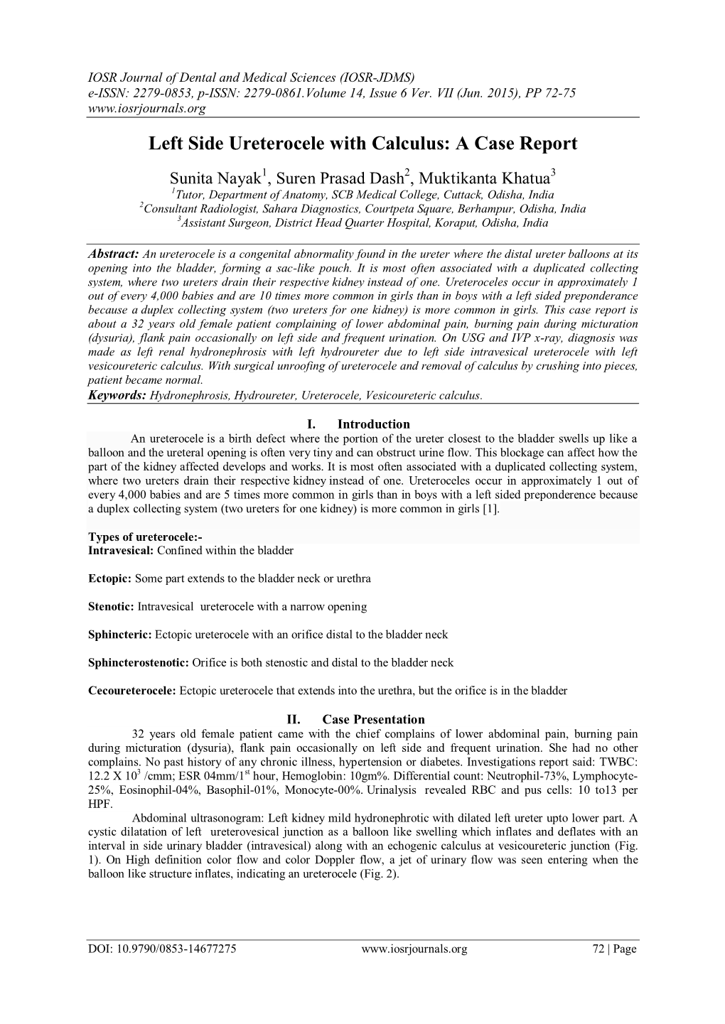 Left Side Ureterocele with Calculus: a Case Report