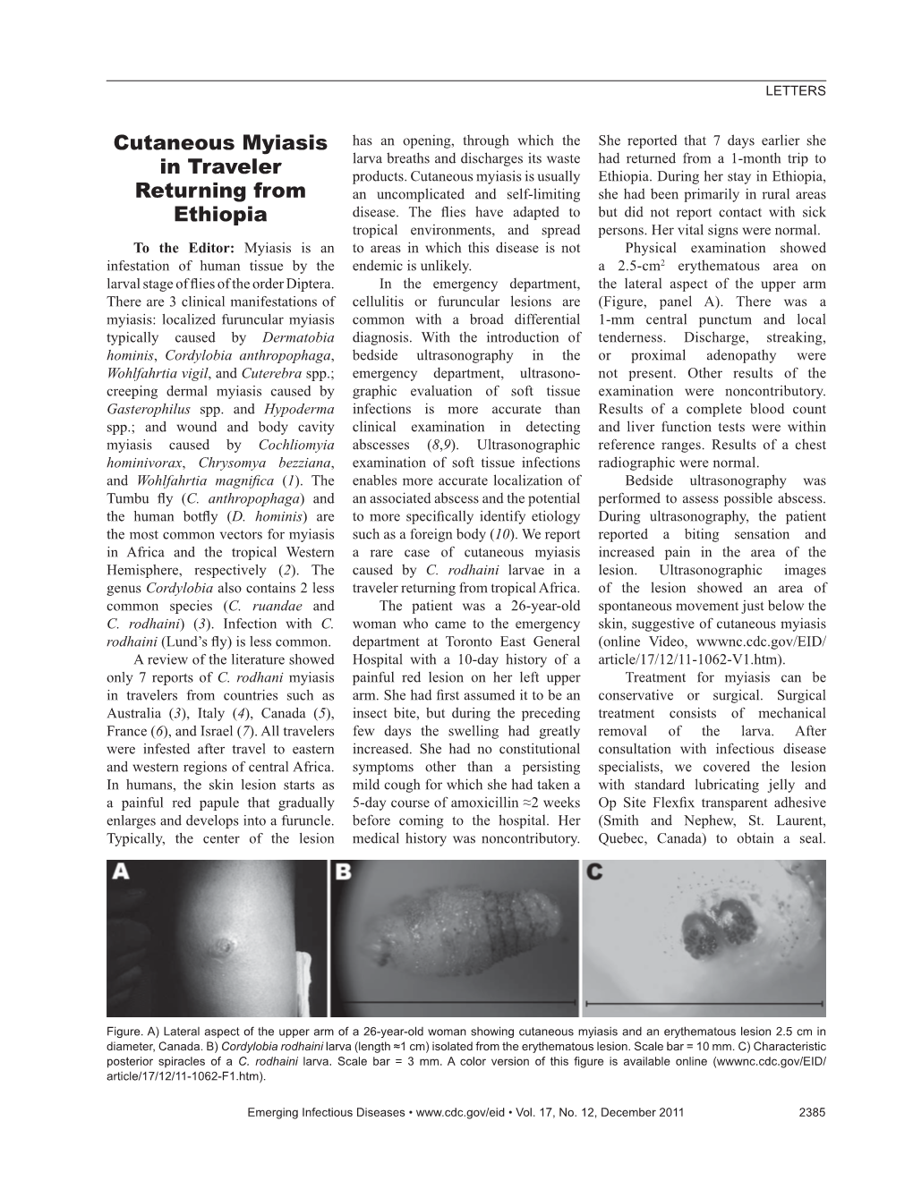 Cutaneous Myiasis in Traveler Returning from Ethiopia