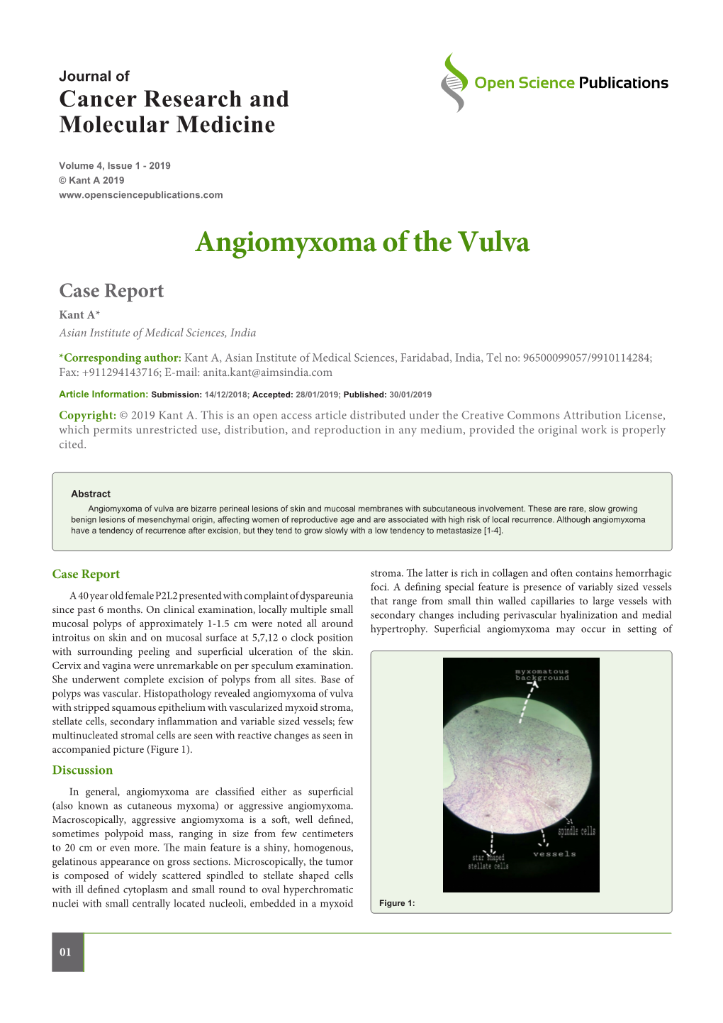 Angiomyxoma of the Vulva