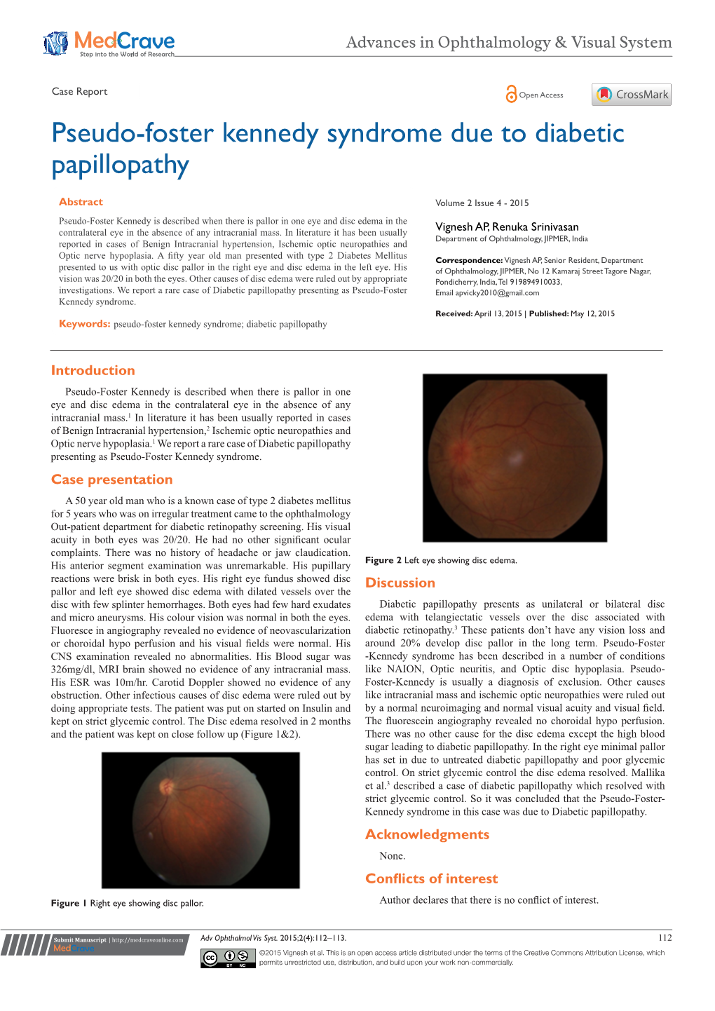 Pseudo-Foster Kennedy Syndrome Due to Diabetic Papillopathy