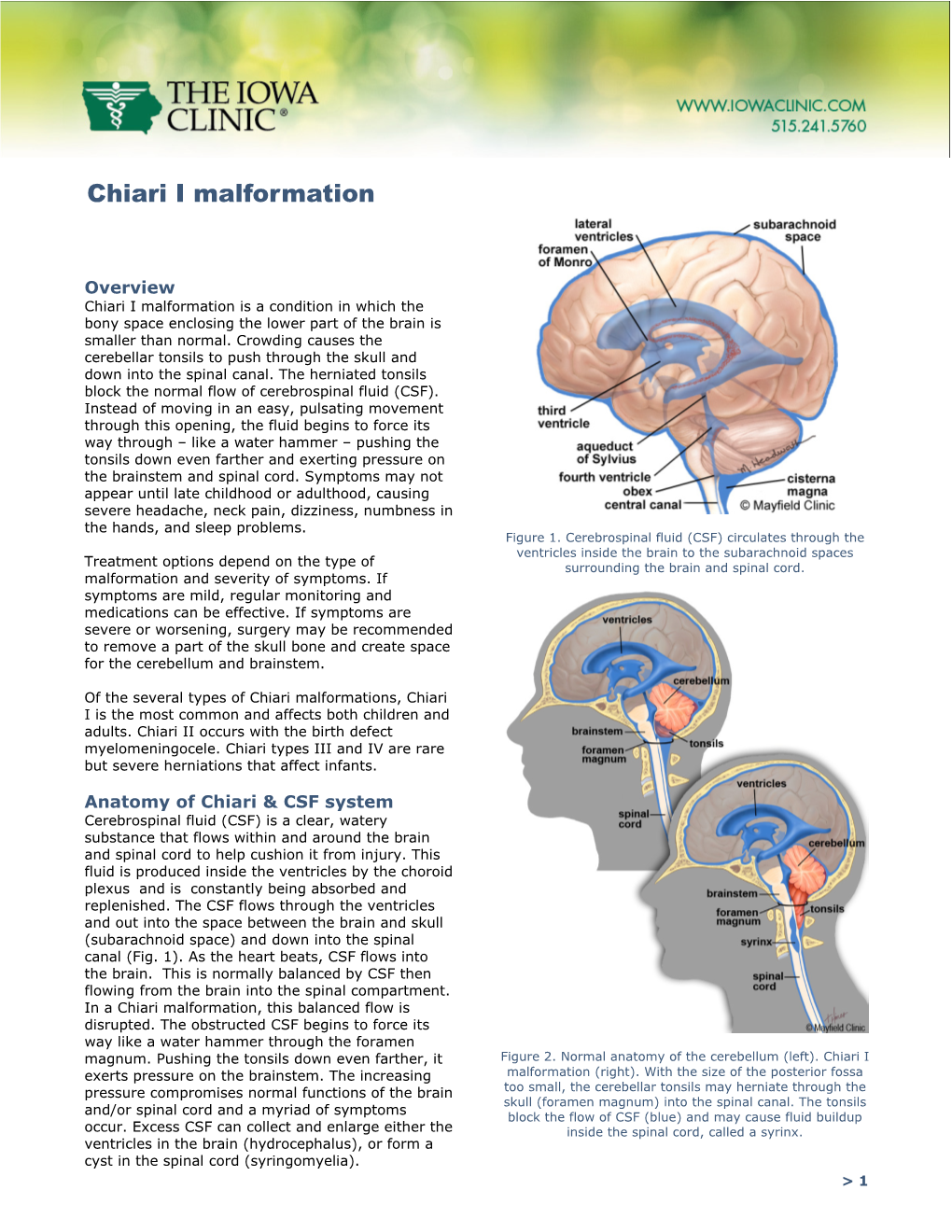 Chiari I Malformation