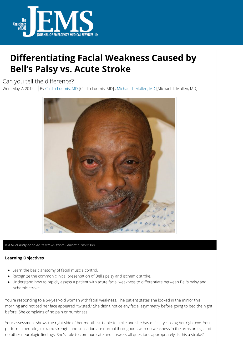 Di Erentiating Facial Weakness Caused by Bell's Palsy Vs. Acute