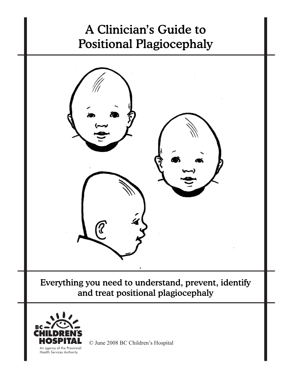 A Clinician's Guide to Positional Plagiocephaly