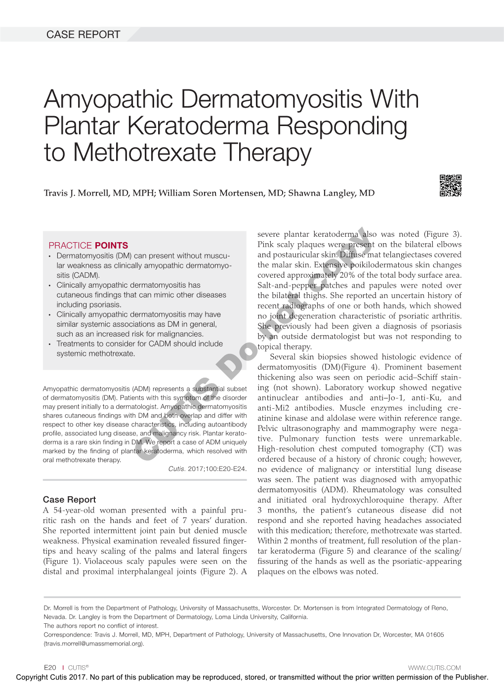 Amyopathic Dermatomyositis with Plantar Keratoderma Responding to Methotrexate Therapy