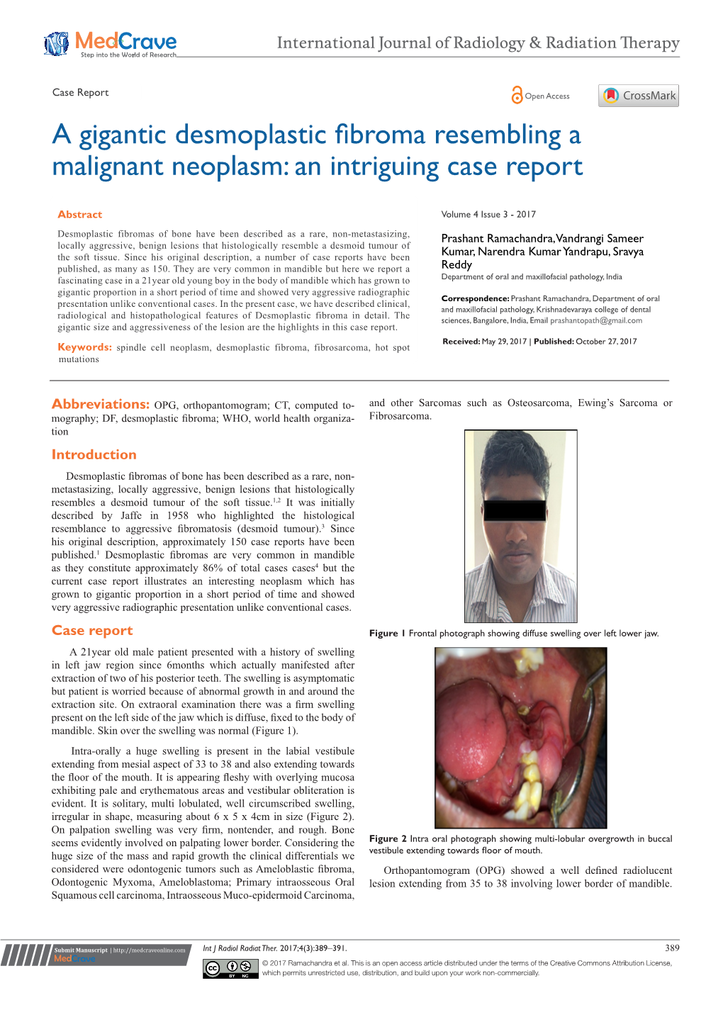 A Gigantic Desmoplastic Fibroma Resembling a Malignant Neoplasm: an Intriguing Case Report