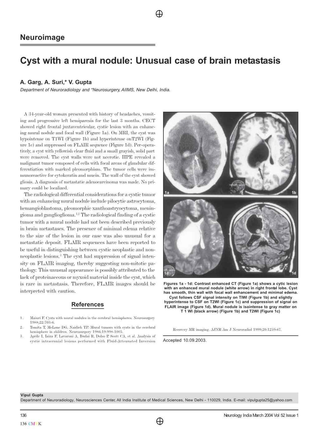 Cyst with a Mural Nodule: Unusual Case of Brain Metastasis