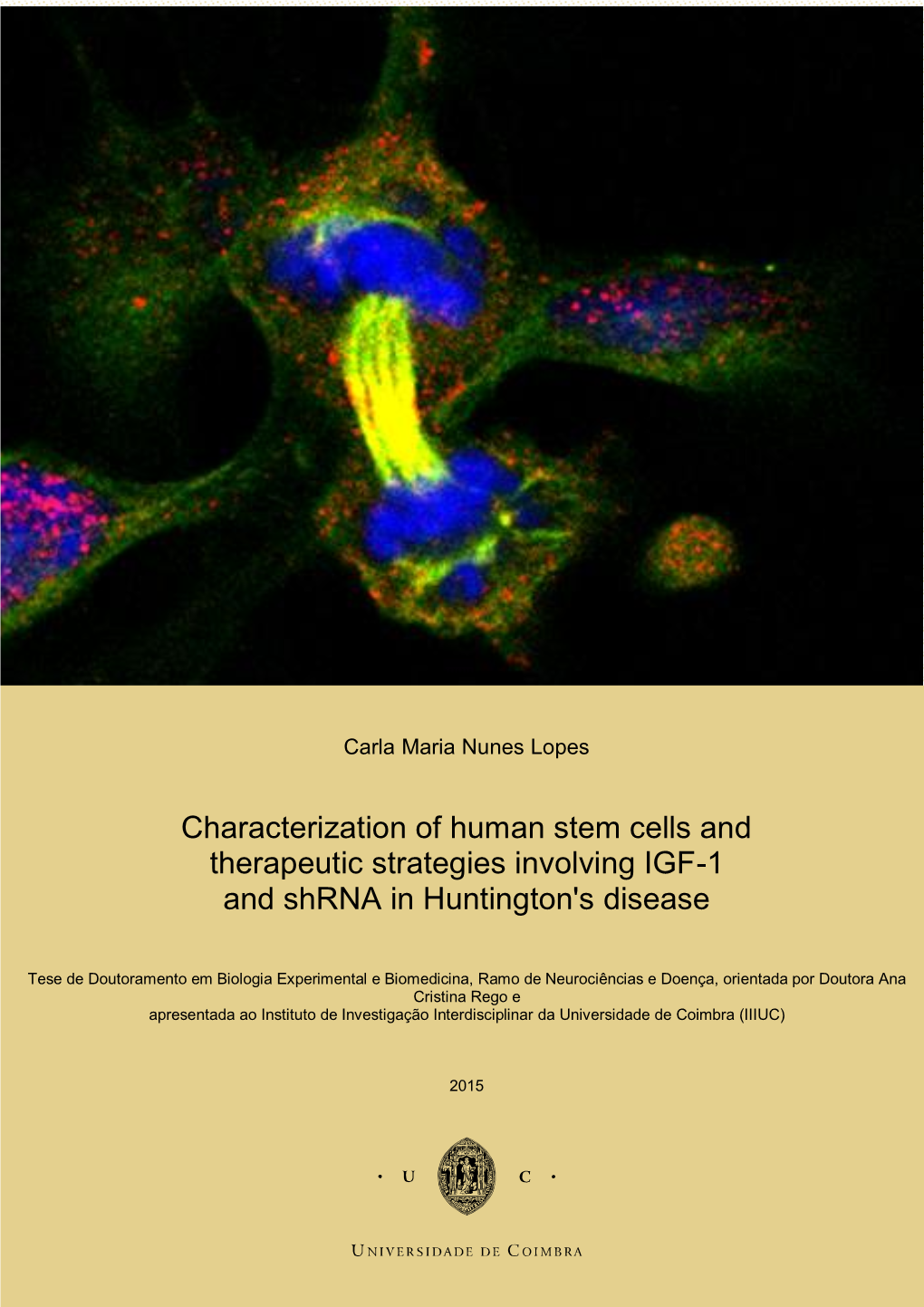 Characterization of Human Stem Cells and Therapeutic Strategies Involving IGF-1 and Shrna in Huntington's Disease