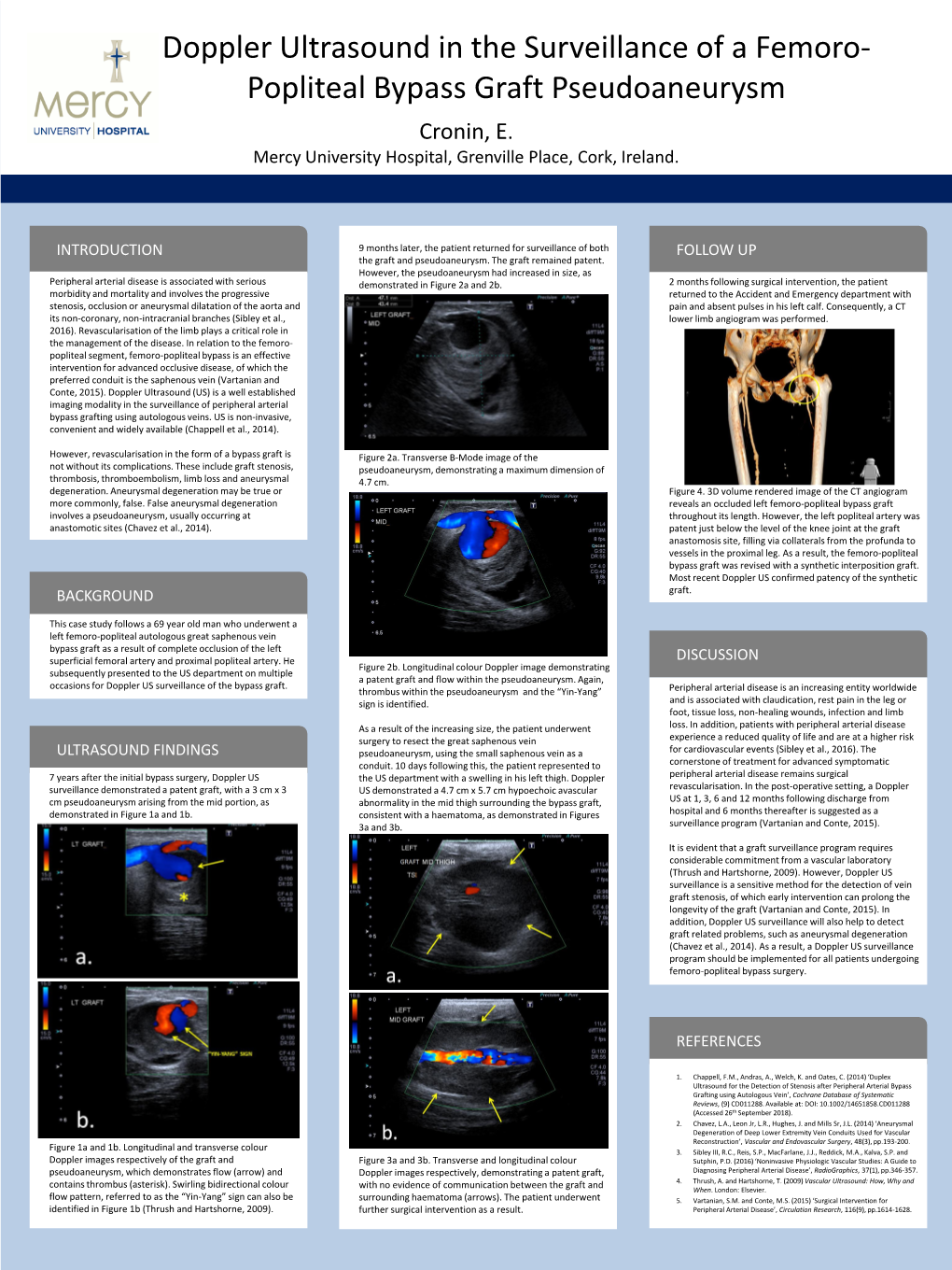 Popliteal Bypass Graft Pseudoaneurysm Printing: Cronin, E