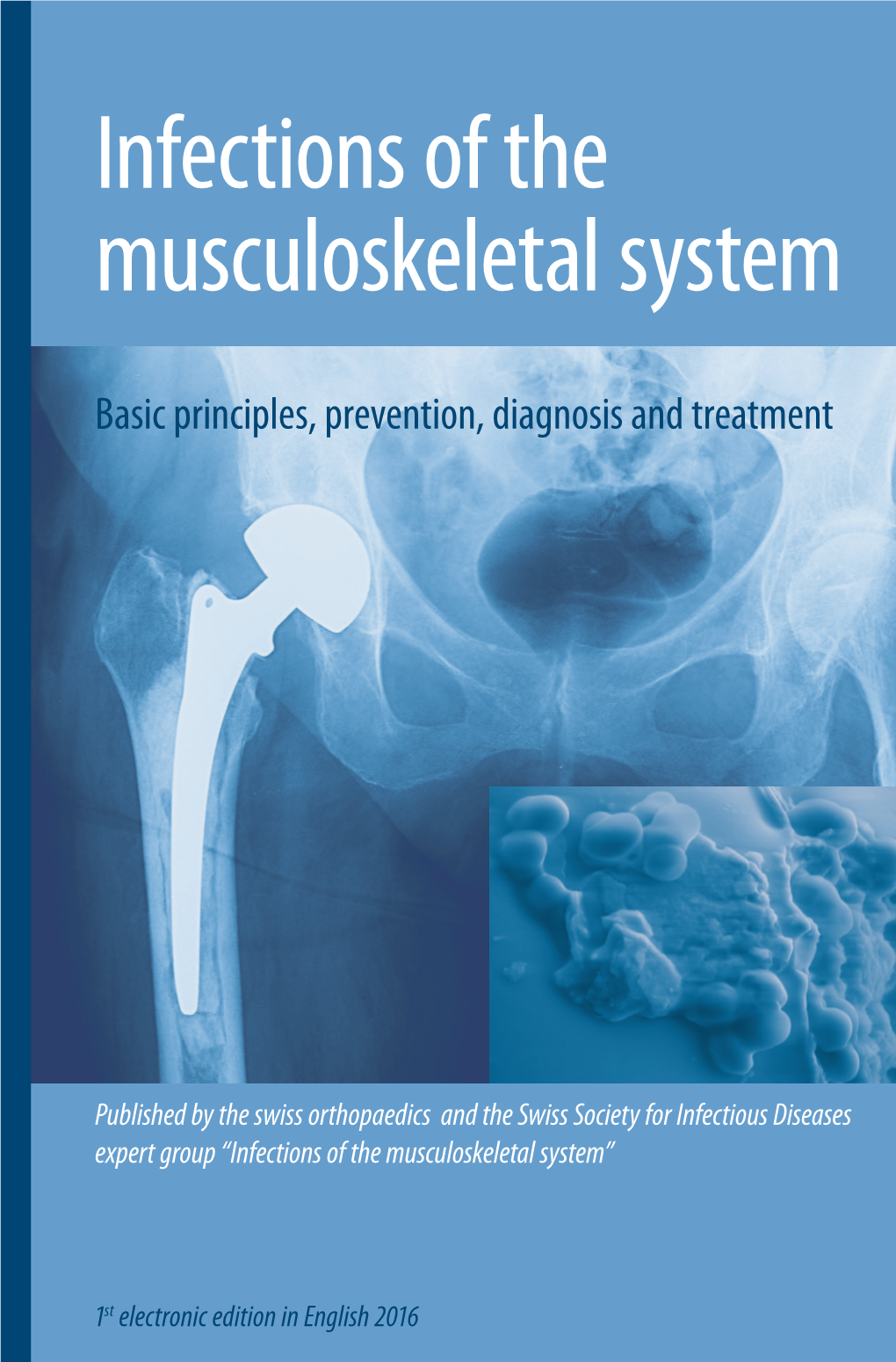 Infections of the Musculoskeletal System”