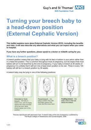 Turning Your Breech Baby to a Head-Down Position (External Cephalic Version)