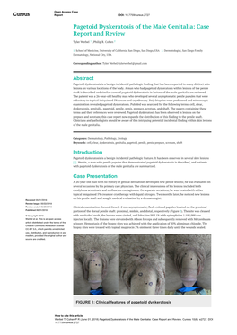 Pagetoid Dyskeratosis of the Male Genitalia: Case Report and Review