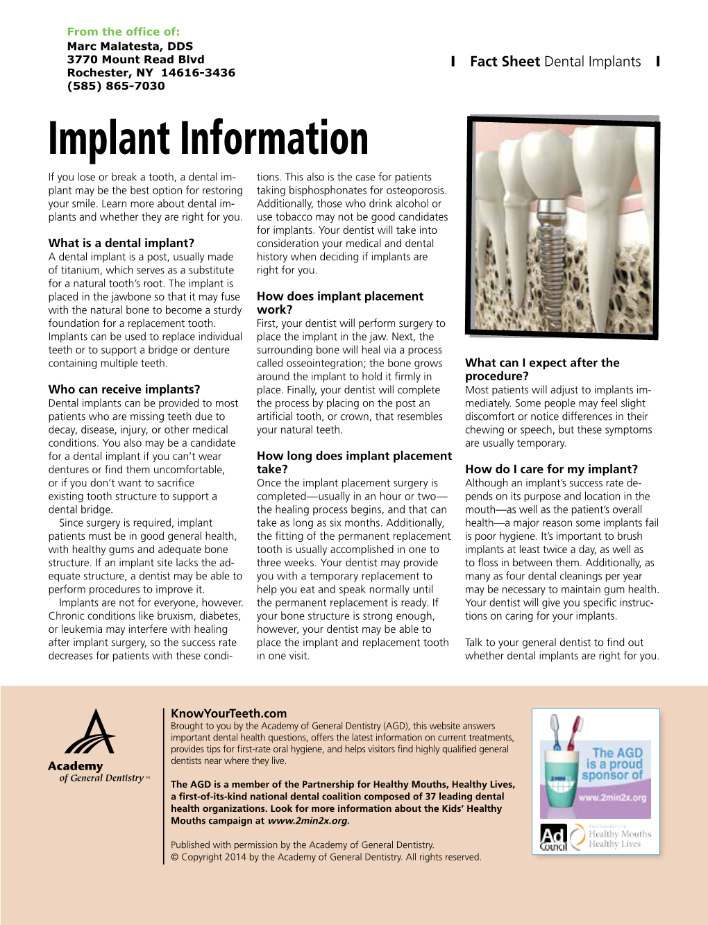 Implant Information If You Lose Or Break a Tooth, a Dental Im- Tions