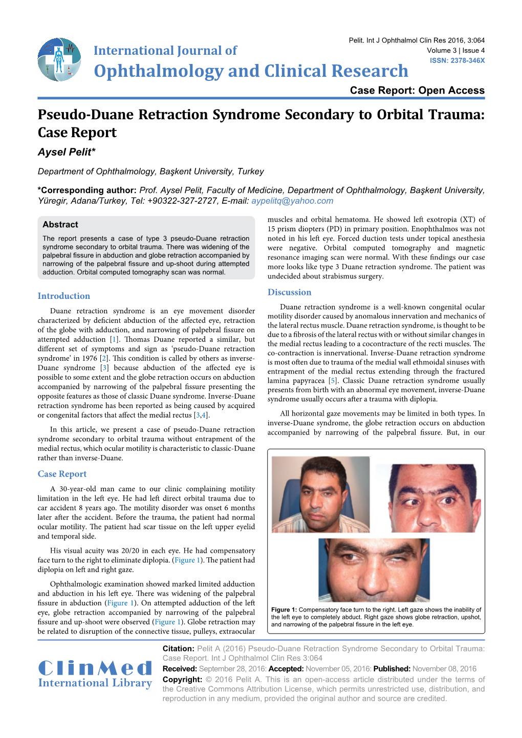 Pseudo-Duane Retraction Syndrome Secondary to Orbital Trauma: Case Report Aysel Pelit*