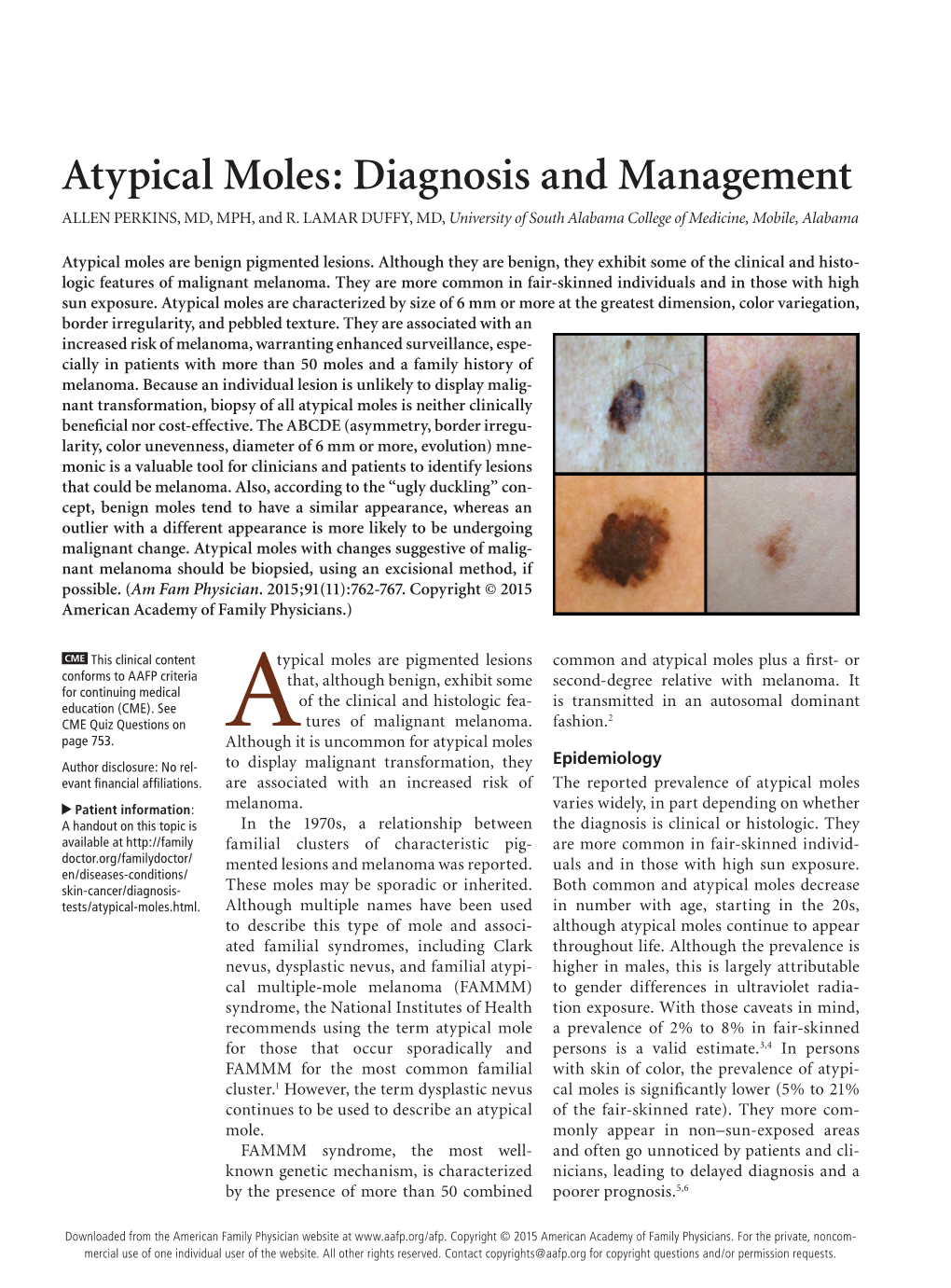 Atypical Moles: Diagnosis and Management ALLEN PERKINS, MD, MPH, and R