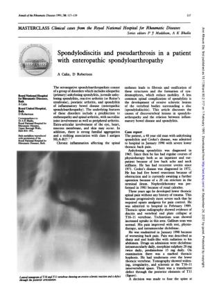 Spondylodiscitis Andpseudarthrosis in a Patient with Enteropathic