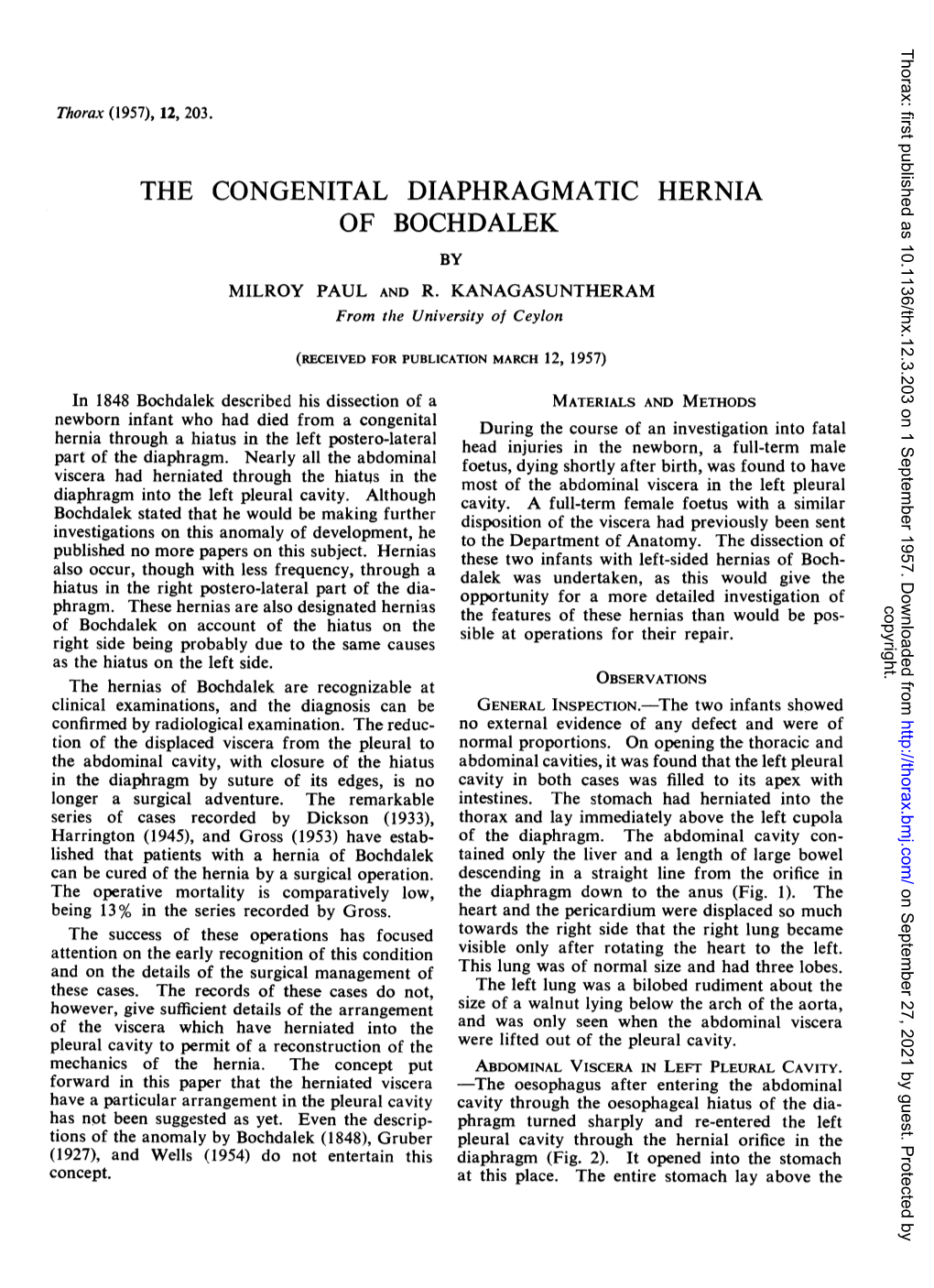 The Congenital Diaphragmatic Hernia of Bochdalek by Milroy Paul and R