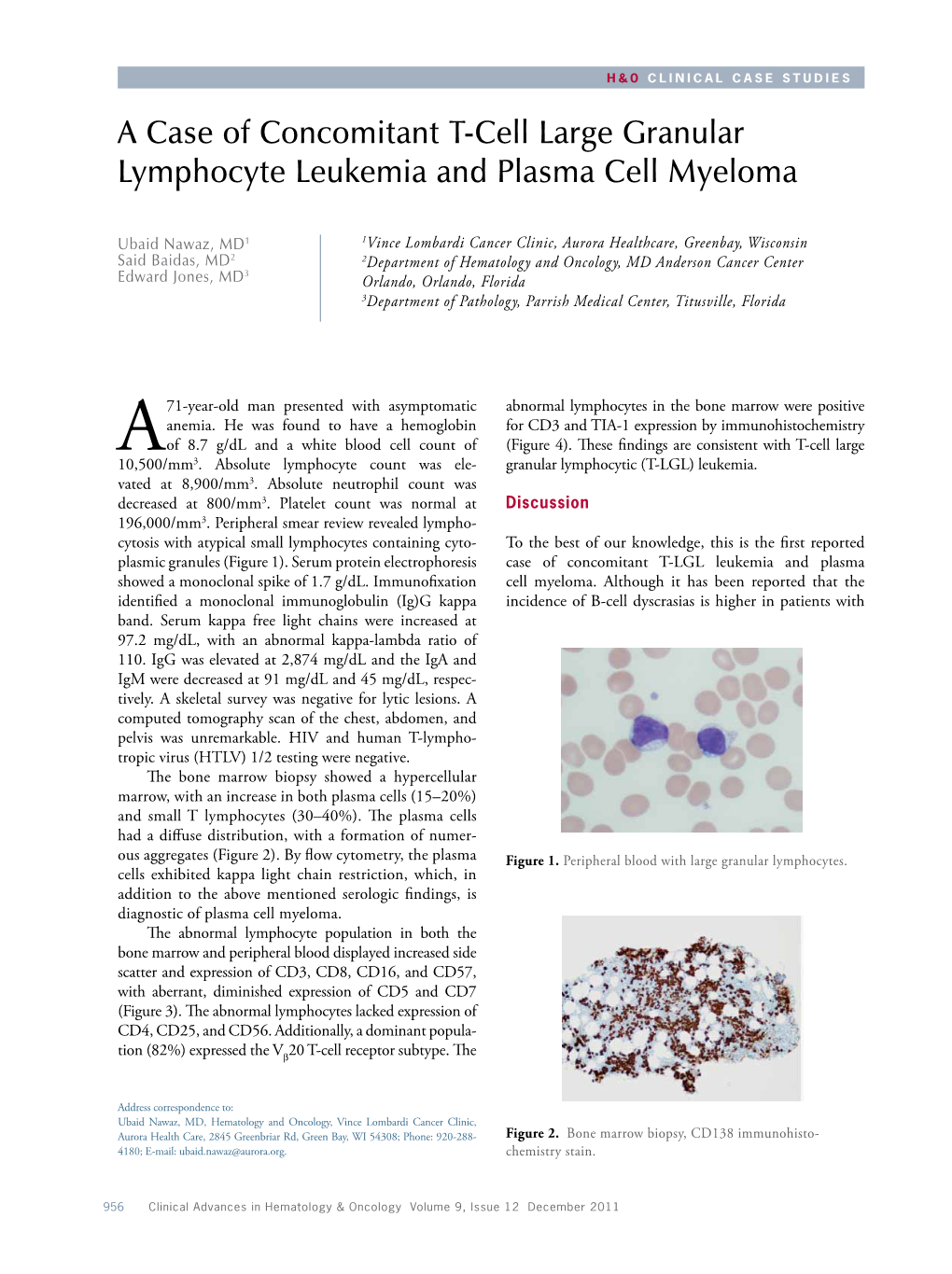 A Case of Concomitant T-Cell Large Granular Lymphocyte Leukemia and Plasma Cell Myeloma