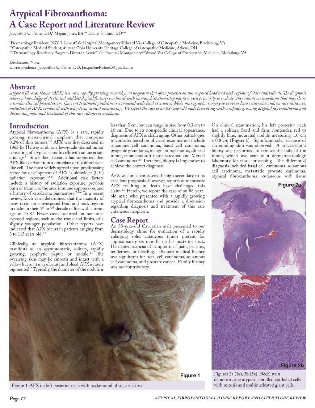 Atypical Fibroxanthoma: a Case Report and Literature Review Jacqueline C