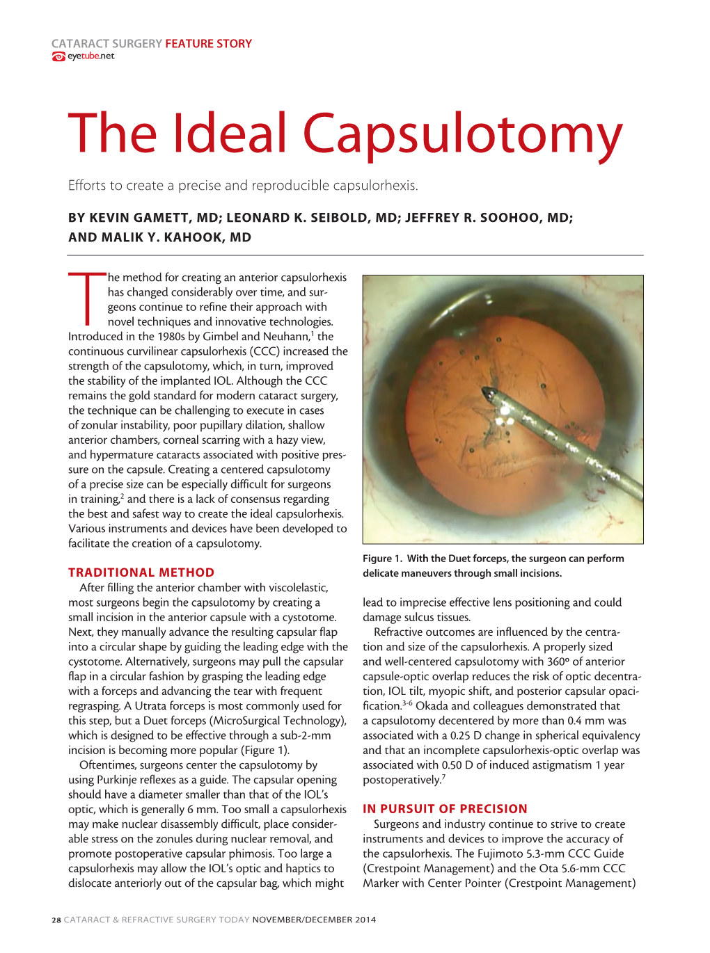 The Ideal Capsulotomy Efforts to Create a Precise and Reproducible Capsulorhexis
