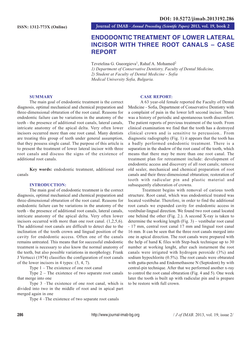 Endodontic Treatment of Lower Lateral Incisor with Three Root Canals – Case Report