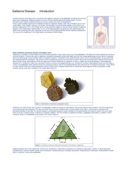 Gallstone Disease: Introduction